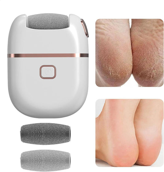 Electronic Pedicure Tool – Smooth, Soft Feet Made Easy